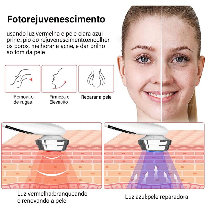 Rejuvenescedor Facial antissinais 4 em 1 recarregável - FLORESDOCERRADO
